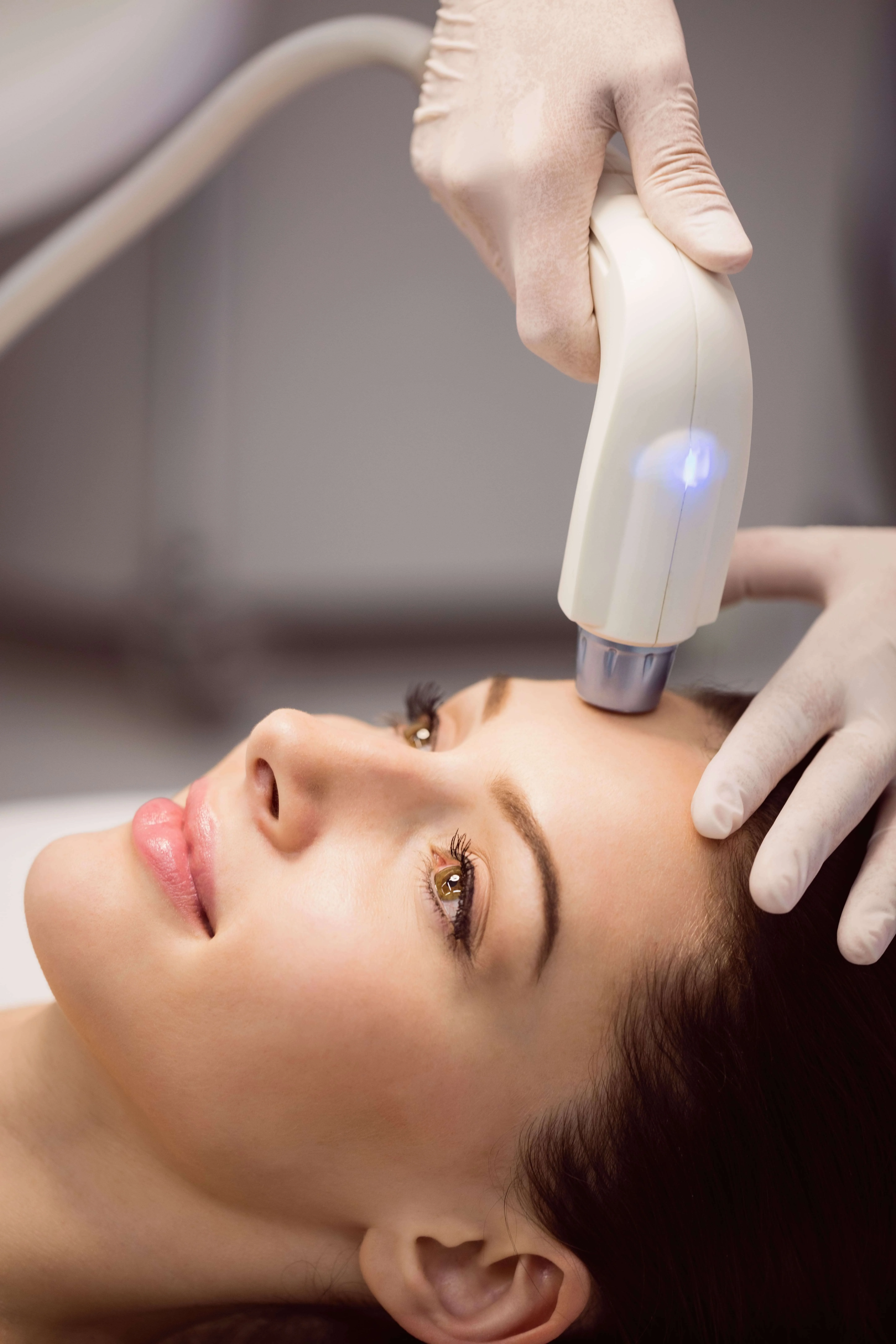 rejuvenecimiento facial laser alicante